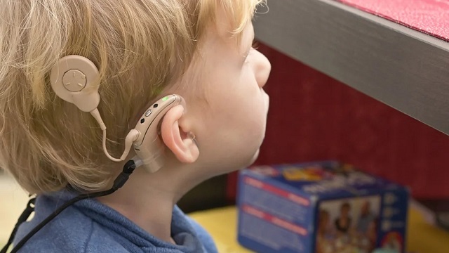 Día Mundial del Implante Coclear: en Argentina más de 500 mil personas viven con problemas auditivos