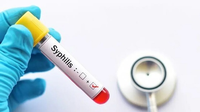 “Crisis en el sistema de salud”: especialistas advierten sobre el aumento de sífilis
